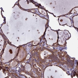PTP-MEG2/PTPN9 Antibody, Novus Biologicals 0.1mL; Unlabeled:Antibodies,